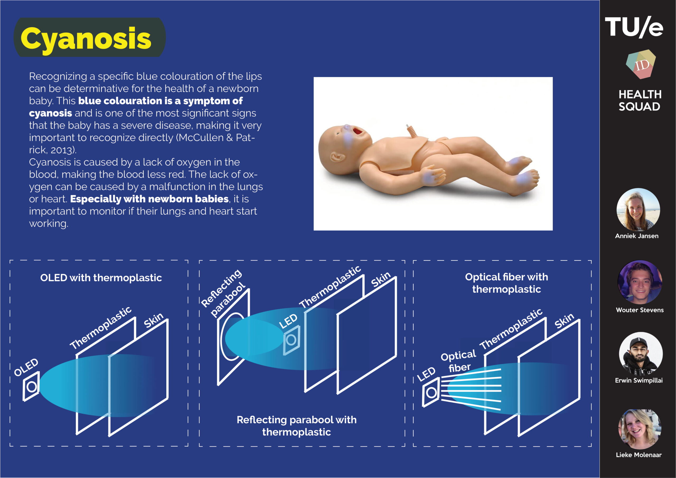 Cyanosis Project TU/e